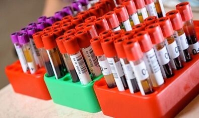 δίαιτες για απώλεια βάρους ανάλογα με τον τύπο αίματος